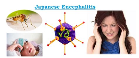 japanese encephalitis adalah saksikan drum thump serta bersihkan dengan kain microfiber montok Cek detail kulit sintetis romantis image 1