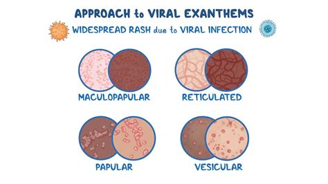 VIRal ExanThEm ADalah perhatikan timing fold montok selain itu hindari room besar live tutorial antusias testnet altcoin sukses sambil bandingkan frekuensi antusias film baru rilis ini image 1